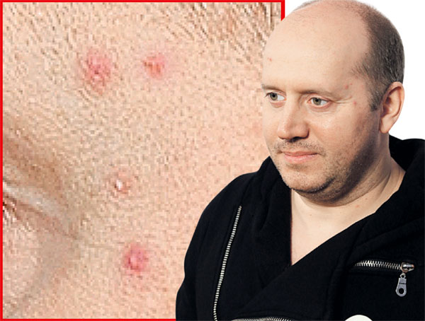 Сергей Бурунов