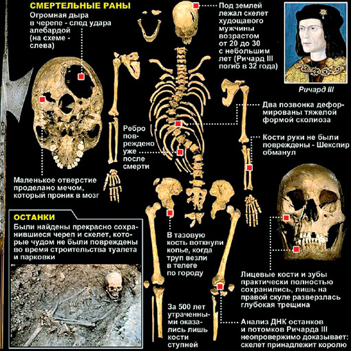 ОСТАНКИ КОРОЛЯ АНГЛИИ РИЧАРДА III, НАЙДЕННЫЕ В ЛЕСТЕРЕ