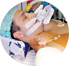 ПОД НАРКОЗОМ: у экс-боксера сон младенца