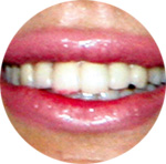 ...губная помада подвела